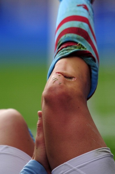 Trong một pha va chạm với Gareth Bale, Joe Bennett của Aston Villa đã dính một chấn thương khá nặng ở chân phải.